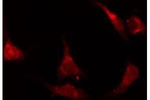 ABIN6274675 staining A549 cells by IF/ICC.