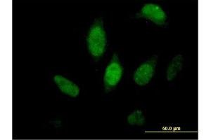 Immunofluorescence of purified MaxPab antibody to FKBP5 on HeLa cell.