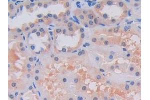 Detection of LOXL2 in Human Kidney Tissue using Polyclonal Antibody to Lysyl Oxidase Like Protein 2 (LOXL2)