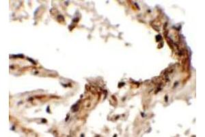 Immunohistochemistry of EMX2 in human lung tissue with EMX2 Antibody at 2. (EMX2 anticorps  (Middle Region))