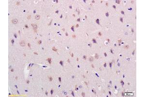 Formalin-fixed and paraffin embedded mouse brain labeled with Rabbit Anti Acylglycerol Kinase Polyclonal Antibody, Unconjugated (ABIN716741) at 1:200 followed by conjugation to the secondary antibody and DAB staining (Acylglycerol Kinase anticorps  (AA 335-422))