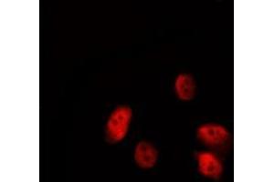 ABIN6277191 staining HepG2 by IF/ICC.