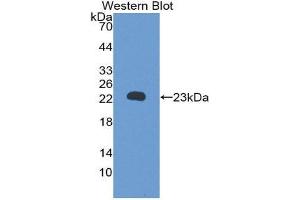 Western Blotting (WB) image for anti-Retinol Binding Protein 5, Cellular (RBP5) (AA 19-201) antibody (ABIN1860415) (Retinol Binding Protein 5 anticorps  (AA 19-201))