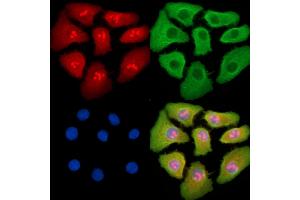 ABIN7095388 and ABIN7099445 staining Hela cells by IF/ICC.