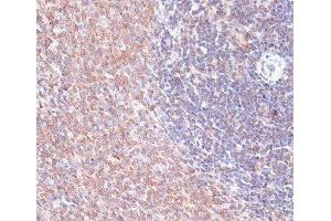 Immunohistochemistry of paraffin-embedded Rat spleen using TMX1 Polyclonal Antibody at dilution of 1:100 (40x lens). (TMX1 anticorps)