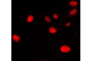 Immunofluorescent analysis of Ku70 staining in HeLa cells.