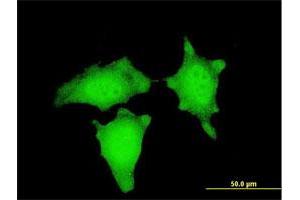 Immunofluorescence of monoclonal antibody to CTNNB1 on HeLa cell. (CTNNB1 anticorps  (AA 682-781))