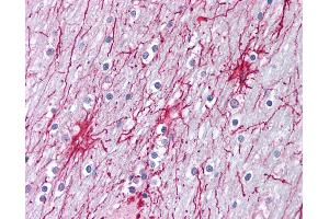 Anti-XPC antibody IHC of human brain, cortex.