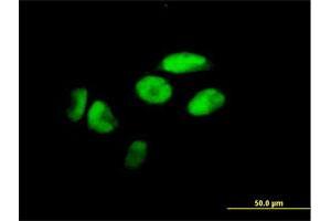 Immunofluorescence of purified MaxPab antibody to ZNF187 on HeLa cell. (ZNF187 anticorps  (AA 1-325))