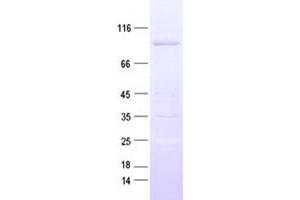Validation with Western Blot