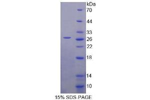 SDS-PAGE analysis of Human HSPA12B Protein. (HSPA12B Protéine)
