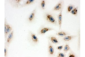 Anti- ATP5H Picoband antibody,ICC ICC: A549 Cell