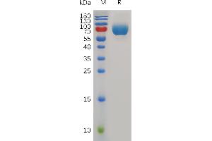 Mouse D Protein, hFc Tag on SDS-PAGE under reducing condition.