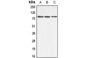 Western blot analysis of ABCB10 expression in HeLa (A), mouse kidney (B), rat kidney (C) whole cell lysates. (ABCB10 anticorps  (Center))