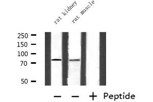 Western blot analysis of extracts from rat kidney and rat muscle, using CEACAM5 Antibody. (CEACAM5 anticorps  (Internal Region))