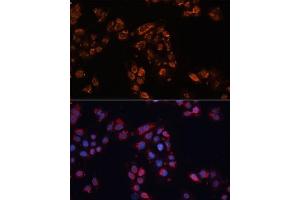 Immunofluorescence analysis of HeLa cells using  antibody (ABIN6129850, ABIN6136348, ABIN6136349 and ABIN6224537) at dilution of 1:100. (ABCB11 anticorps  (AA 600-750))