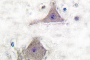 Image no. 2 for anti-Glutamate Receptor, Metabotropic 7 (GRM7) antibody (ABIN265440) (GRM7 anticorps)