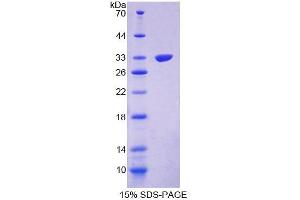 SDS-PAGE analysis of Mouse PPP1R15A Protein. (Protein phosphatase 1 (Regulatory Subunit 15A) Protéine)
