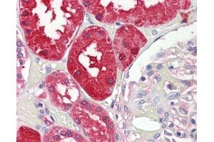 anti-Aminoacylase 1 (ACY1) antibody