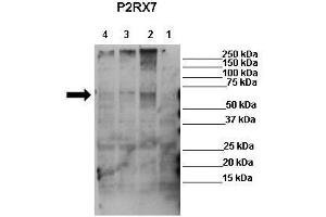 WB Suggested Anti-P2RX7 Antibody  Positive Control: Lane 1: 50ug mock transfected HEK-293Lane 2: 50ug hP2X7 transfected HEK-293Lane 3: 50ug mP2X7 transfected HEK-293Lane 4: 50ug rP2X7 transfected HEK-293 Primary Antibody Dilution :  1:625 Secondary Antibody : Anti-rabbit-HRP Secondry Antibody Dilution :  1:1000 Submitted by: Ronald Sluyter, School of Biological Sciences, University of Wollongong (P2RX7 anticorps  (Middle Region))