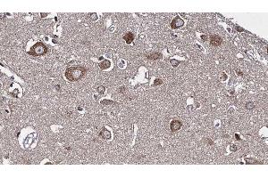ABIN6277226 at 1/100 staining Human brain cancer tissue by IHC-P. (RIPK2 anticorps  (N-Term))