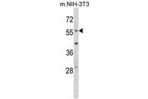 Image no. 1 for anti-Early Growth Response 1 (EGR1) (N-Term) antibody (ABIN452942) (EGR1 anticorps  (N-Term))