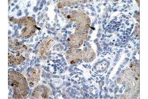 Image no. 1 for anti-Zinc Finger, MYM-Type 6 (ZMYM6) (AA 625-674) antibody (ABIN6735985)