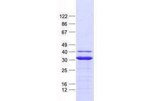 Validation with Western Blot