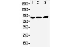 Anti-NUR77 antibody, Western blotting Lane 1: A431 Cell Lysate Lane 2: HELA Cell Lysate Lane 3: JURKAT Cell Lysate