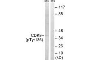 Western blot analysis of extracts from NIH-3T3 cells treated with Forskolin 40nM 30', using CDK9 (Phospho-Thr186) Antibody. (CDK9 anticorps  (pThr186))