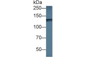 Western blot analysis of Human HeLa cell lysate, using Mouse NIN Antibody (1 µg/ml) and HRP-conjugated Goat Anti-Rabbit antibody ( (Ninein anticorps  (AA 1-153))