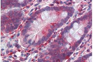 Human Small Intestine (formalin-fixed, paraffin-embedded) stained with SCML1 antibody ABIN462201 followed by biotinylated goat anti-rabbit IgG secondary antibody ABIN481713, alkaline phosphatase-streptavidin and chromogen.