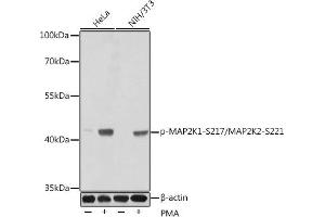 Western blot analysis of extracts of various cell lines, using Phospho-MK1-S217/MK2-S221 antibody (ABIN3019811, ABIN3019812, ABIN3019813, ABIN1681751 and ABIN1681752) at dilution. (MEK1 anticorps  (pSer221, Ser217, Ser221))