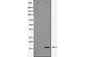 Western blot analysis of HEK293 cell lysate, using CST8 Antibody. (CST8 anticorps  (Internal Region))