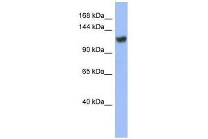 ZNF423 antibody used at 0. (Znf423 anticorps  (Middle Region))
