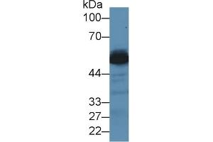 Detection of ALT in Mouse Liver lysate using Polyclonal Antibody to Alanine Aminotransferase (ALT)