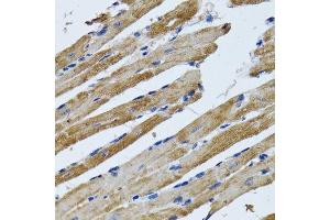 Immunohistochemistry of paraffin-embedded rat heart using ATP5B antibody.
