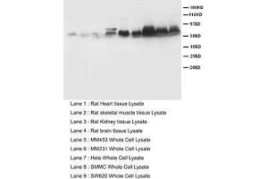 Western blot with Smad 1,2,3,5 Polyclonal Antibody (SMAD1 anticorps  (C-Term))