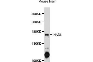 Western blot analysis of extracts of mouse brain, using INADL antibody (ABIN5997988) at 1/1000 dilution. (PATJ anticorps)