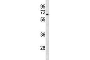 HAS3 antibody western blot analysis in A549 lysate. (HAS3 anticorps  (AA 137-164))