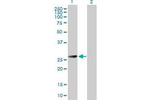 Western Blot analysis of BCAP31 expression in transfected 293T cell line by BCAP31 MaxPab polyclonal antibody.