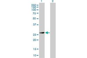 Western Blot analysis of BCAP31 expression in transfected 293T cell line by BCAP31 MaxPab polyclonal antibody. (BCAP31 anticorps  (AA 1-246))