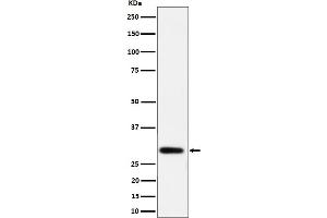 Western blot analysis of NAT1 expression in LnCaP cell lysate.