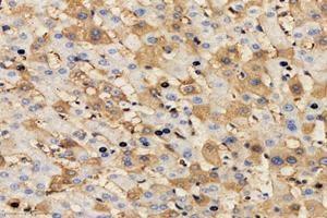 Immunohistochemistry analysis of paraffin-embedded human liver using,MRPL51 (ABIN7074649) at dilution of 1: 4000
