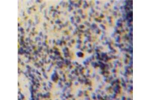 Used in DAB staining on fromalin fixed paraffin-embedded Spleen tissue