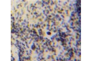Used in DAB staining on fromalin fixed paraffin-embedded Spleen tissue (GDF3 anticorps  (AA 253-366))