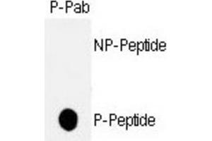 Dot Blot (DB) image for anti-Tumor Protein P53 (TP53) (pThr18) antibody (ABIN2970970)
