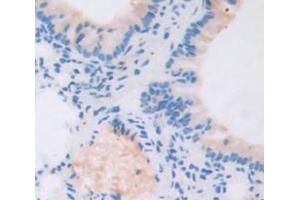 Figure. (TBX3 anticorps  (AA 107-220))