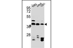 HNRNPC Antibody (C-term) (ABIN654685 and ABIN2844378) western blot analysis in Jurkat,K562, cell line lysates (35 μg/lane). (HNRNPC anticorps  (C-Term))