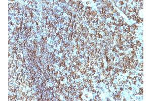 Formalin-fixed, paraffin-embedded human Tonsil stained with HLA-DRB Monoclonal Antibody (SPM288). (HLA-DRB1 anticorps)